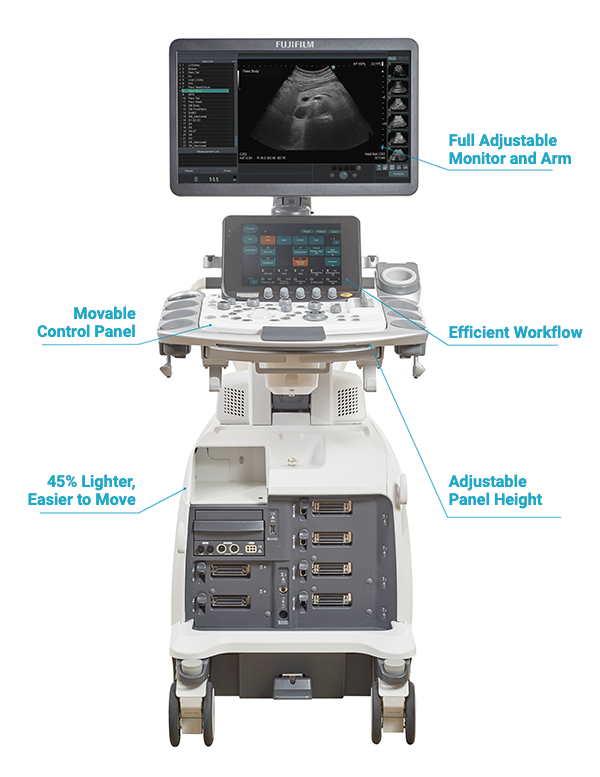 ARIETTA 750 Laparoscopic Surgery Headon Shot with Callouts