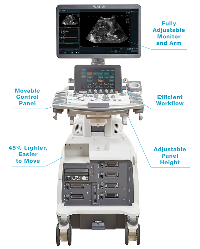 ARIETTA 750 Neurosurgery Brochure Callouts