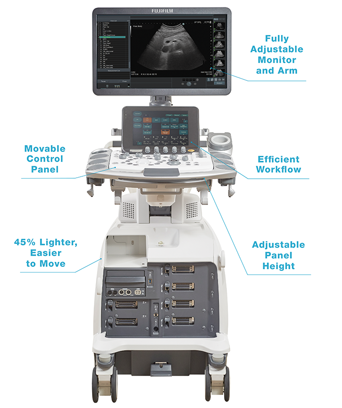 ARIETTA 750 Surgicol Oncollogy Machine Call Outs