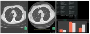 Oncology Viewer